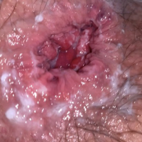 Petruari 6 rd anal batsi lusankarner