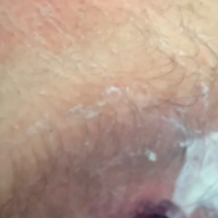 Petruari 6 rd anal batsi lusankarner