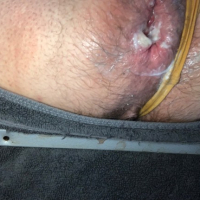 Petruari 6 rd anal batsi lusankarner