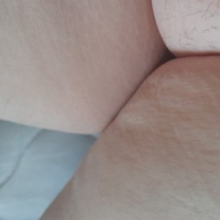 Vagineteton