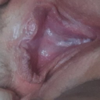 Vagineteton