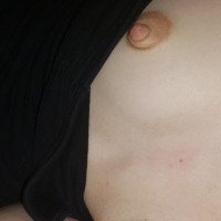 Titties y tarmatsvel e