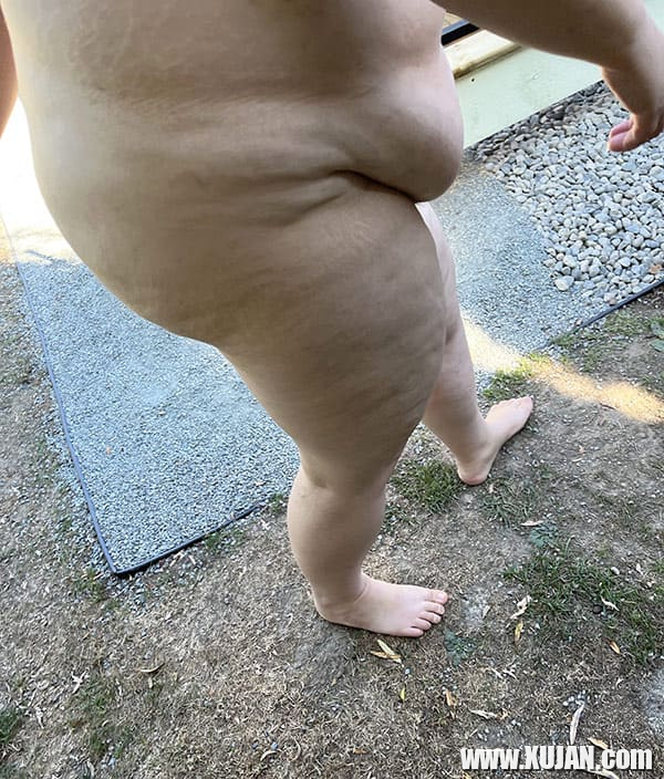 Fat arpi kiny nudist zbosnum e erkrum merk - Photo #3113599