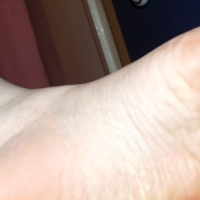 Toe Rings