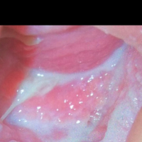 Vernagir 1