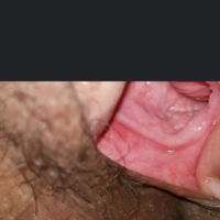 Vernagir 1