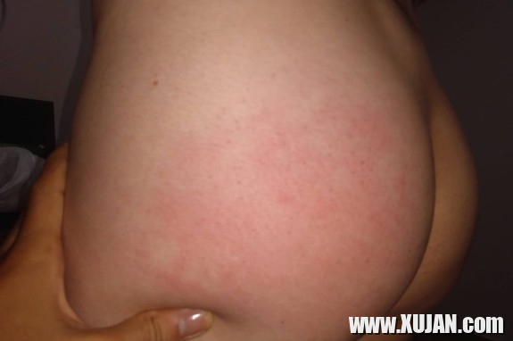Cyc xxx - Photo #3126752