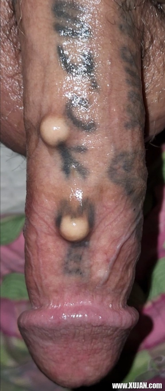 Ynkerner ovqer sirum en im margarit implantnery - Photo #3317838