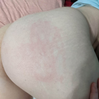 Papuk Cat Girl Ass