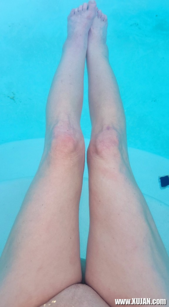 Milf post fuck gape pucy pooltime - Photo #3318815