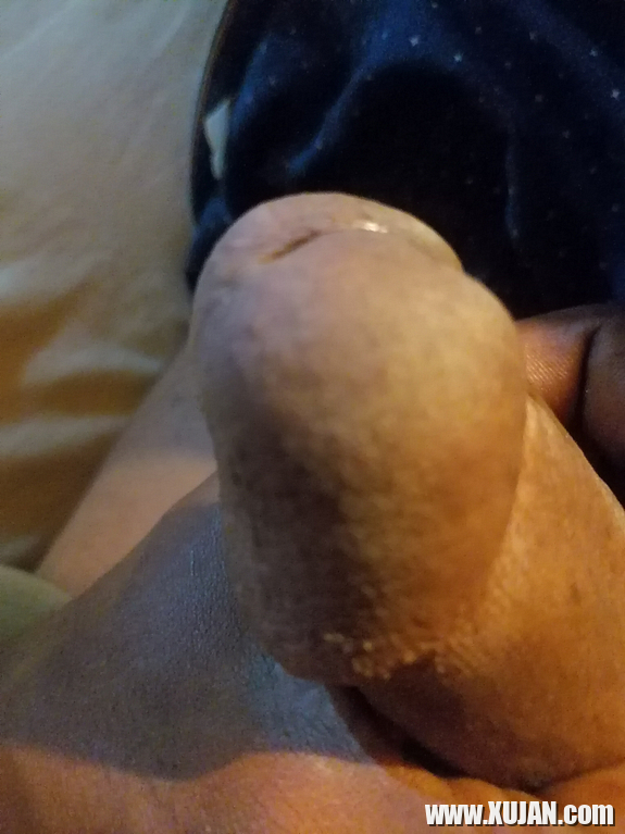 SuGarSweetCane - Photo #3386861