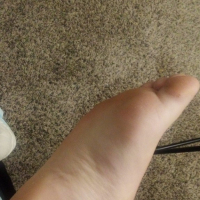 LilLillyFeet