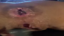 Anal bruntsqi sheghum