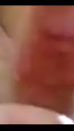 отсасывает авикян мадина