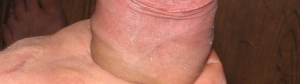 AARTA