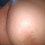 Anal1975