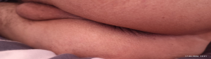 Anal1975